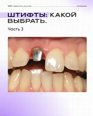 Самые частые ошибки при работе со штифтами.